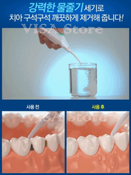 牙線機非歐樂BOral-B 沖牙機 洗牙器 空氣動能 水牙線機 沖牙器 牙套 假牙牙齒矯正清潔 