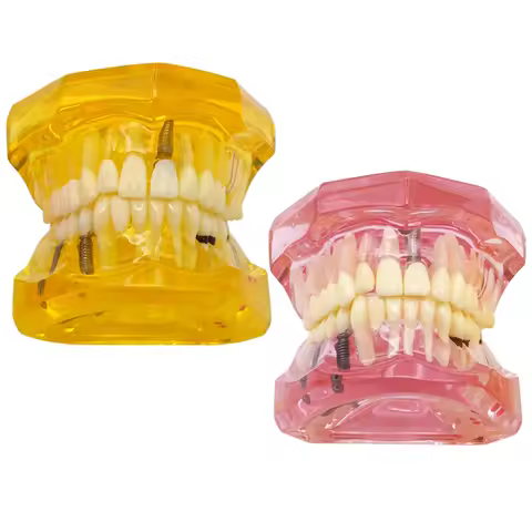 1pc Removable dental models, yellow and pink dental teaching models, resin dental models, oral denta