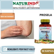 Prosela obat sakit kulit gatal