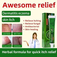 Eczema Treatment Cream, Antipruritic Cream, Eczema Psoriasis Antibacterial Treatment, Skin Fungal In