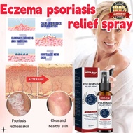 Eczema Psoriasis Antifungal Spray Anti Itch Eczema Relief Herba Antifungal Spray Krim Gatal Kulit He