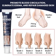 Sumifun Edema Cream Dredging Cream Leg Floating Swelling Massage K102820601226/A10/280