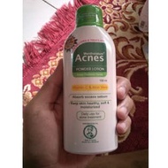 Acnes Powder Lotion 100ml