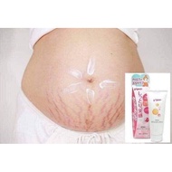 Stretch mark cream