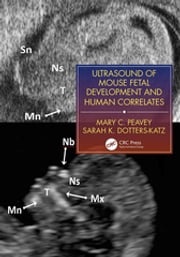 Ultrasound of Mouse Fetal Development and Human Correlates Mary C. Peavey