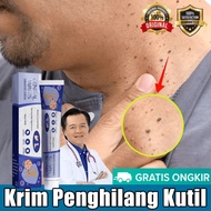 Warts Remover Pure Kasoy Cream Warts Remover Original Mole Remover Kulogo Buni Removal Warts Removal