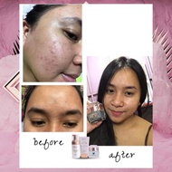 la'soul skin care all skin type