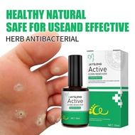 【3วันเจอผล】【ทดลองใช้ฟรี 7 วัน】10Ml Remove Foot Corn Care Cream Effectively Anti Infection Paronychia