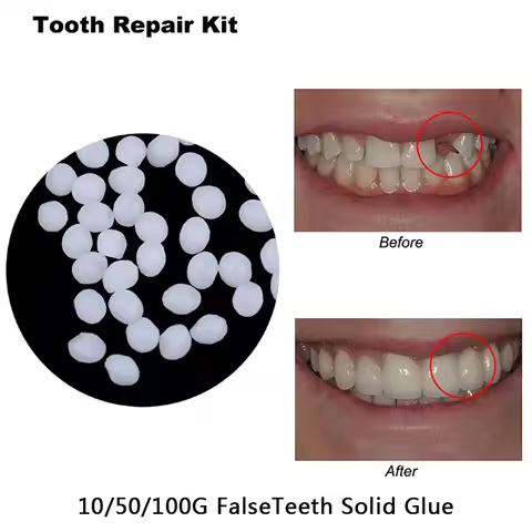 5/10/20/50/100g Dental Resin Shapeable Teeth Glue Temporary Filling Teeth Repair Makeup Dental Mater