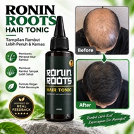 Ronin Roots Hair Tonic by Abang Karim Jambang Solution