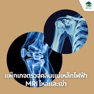 [E-Coupon] แพ็กเกจราคาพิเศษ ตรวจคลื่นแม่เหล็กไฟฟ้า MRI ไหล่และเข่าที่โรงพยาบาลบีเอ็นเอช