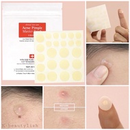 Cosrx Acne Pimple Patch (Authentic)