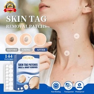 Wart Remover Patch ubat buang kutil ketuat tahi lalat biji kolestrol Skin Tags Patches Callus Corns 