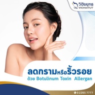 [E-Voucher] รพ.วิชัยยุทธ - ลดกรามหรือลดริ้วรอย ด้วยการฉีด Botulinum Toxin Allergan ของอเมริกา