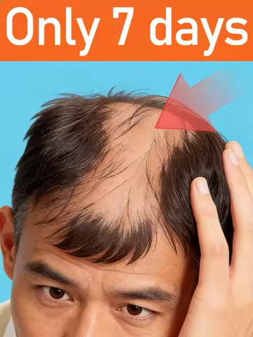 Gentle spray to help people with thinning hair on the top of their head; suitable for both men and w