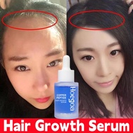 Hair Growth Serum Hair Tonic Growth Serum Rambut Lebat Hair Serum For Hair Growth Pelebat Rambut Imp