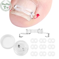 DayDayTo 1/2 Set Ingrown Toenail Corrector Tools Pedicure Recover Embed Toenail Treatment Profession