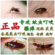 Bed bugs, fleas, mosquito bites, itching, scar cre臭虫跳蚤蚊虫叮咬止痒祛疤膏皮肤过敏瘙痒消肿外专用药q_gupqoidoq0uso_gl31olr65