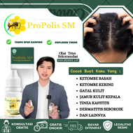 Obat Tetes Ketombe Basah Kering Penghilang Gatal Kulit Kepala Akibat Jamur Kulit Kepala Tinea Kapiti
