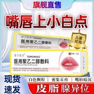White spots on lips, ectopic sebaceous glands, dryness, crac嘴唇白点颗粒皮脂腺异位引起白斑周暗干裂脱皮唇炎卫生材料及敷料7.1