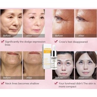 LANBENA 24K Gold Six Peptides Serum Anti-Wrinkle Anti-Aging Serum,Six Peptides Pure Collagen Protein