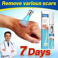【Fast Scar Removal】Laser Scar Pen – Fades Keloids, Acne Scars & Stretch Marks Effectively Acne Scar 