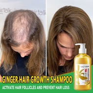 Anti hair loss shampoo Hair growth shampoo Hair loss shampoo 500ml Nourish the scalp and strengthen the hair roots防脱育发