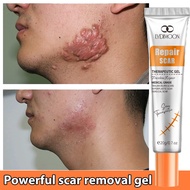 Scar removal cream acne scar removal scar gel 20g Repair and lighten all kinds of acne scars, inhibi
