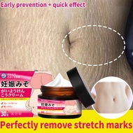 Anti Stretch Mark Cream Stretch Mark Remover Cream Scars Remover Cream Improvement and Elimination o