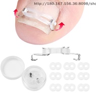 [TE] 1/2 Set Ingrown Toenail Corrector Tools Pedicure Recover Embed Toenail Treatment Professional F