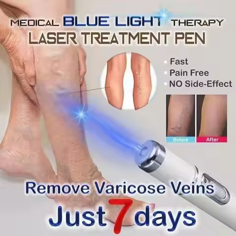 Blue Light Therapy Varicose Vein Pen Medical Varicose Scar Vein Pen Light Blue Acne Therapy Treatmen