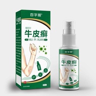 Baiziju Cowhide Raising Spray Dermatitiss Spray Psoriasis Spray Skin Dermatis Eczema20260403