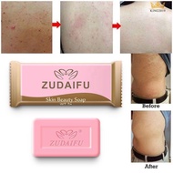 Sabun Jerawat Badan Panau Kurap Gatal enzema Skin Soap Elergic Itch Body acne