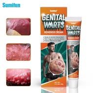 Original Kasoy Cream Warts Remover Cream Painless Kasoy Oil Skin Tags Mole Remover Kulogo Remover Ge
