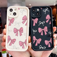 Xiaomi 15 14T Pro 15 Ultra POCO C65 F3 X5 F6 X6 X3 M6 M7 Case Redmi 14C 10C 11S 13C 12 11C 13 14C 9 