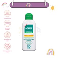 Jelita - ACNES Powder Lotion 100ml