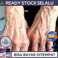 Obat Varises Obat Untuk Varises Obat Untuk Urat Menonjol Obat Urat Timbul Obat Varicose Veins Obat A
