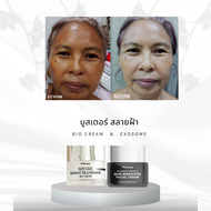 ชุดทาฝ้า ไบโอครีม + Exosome PL Skincare