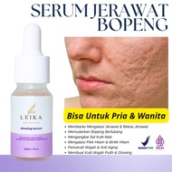 Effective Permanent acne Scar Remover for Men Bpom Most Effective Removes acne Scars acne and acne S