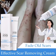 ครีมลดรอยแผลเป็น ลบรอยแผลเป็น สำหรับรอยสิว แผลเป็นจากการผ่าตัด แผลเป็นจากการบาดเจ็บ สูตรสมุนไพร Herbal Scar Removal Cream Gel Acne Spots Burn Surgical Scars Treatment Smooth Whitening Face Body Skin Care 30g