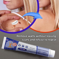 wart removal skin tag removal wart cream Wart Removal Ointment cream mole removal cream mole remover