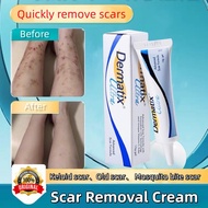 FC31  Scar Removal Cream Keloid Scar Removal dermatix ultra Scar Gel Acne Scar Removal Mosquito Bite