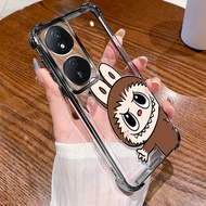 For Honor X7B Phone Case Soft Silicone Electroplating TPU SoftCase Four Corners Anti-drop Cartoon Sh