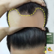 penumbuh rambut penumbuh rambut botak serum penumbuh rambut 30g