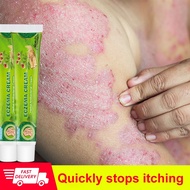 Eczema Cream Ubat gatal kulit Antifungal cream ubat gatal kulit farmasi Eczema Psoriasis cream 20g o