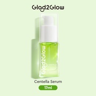 GLAD2GLOW ACNE SERUM 17ML| ACNE SERUM
