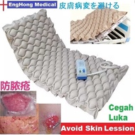 Ripple Mattress Air Mattress Hospital bed nursing bed with Controller LOWEST PRICE, (Tilam Angin, Ti