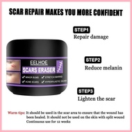 ✻ ☬ EELHOE Original Scar Repair Cream for old scar stretch mark remover acne scar remover Aliver sc