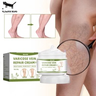 FR Varicose Veins Effective Remover Cream Pain Relief Vein Bioderm Ointment 50g