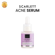 SCARLETT WHITENING ACNE SERUM - SERUM JERAWAT SCARLETT